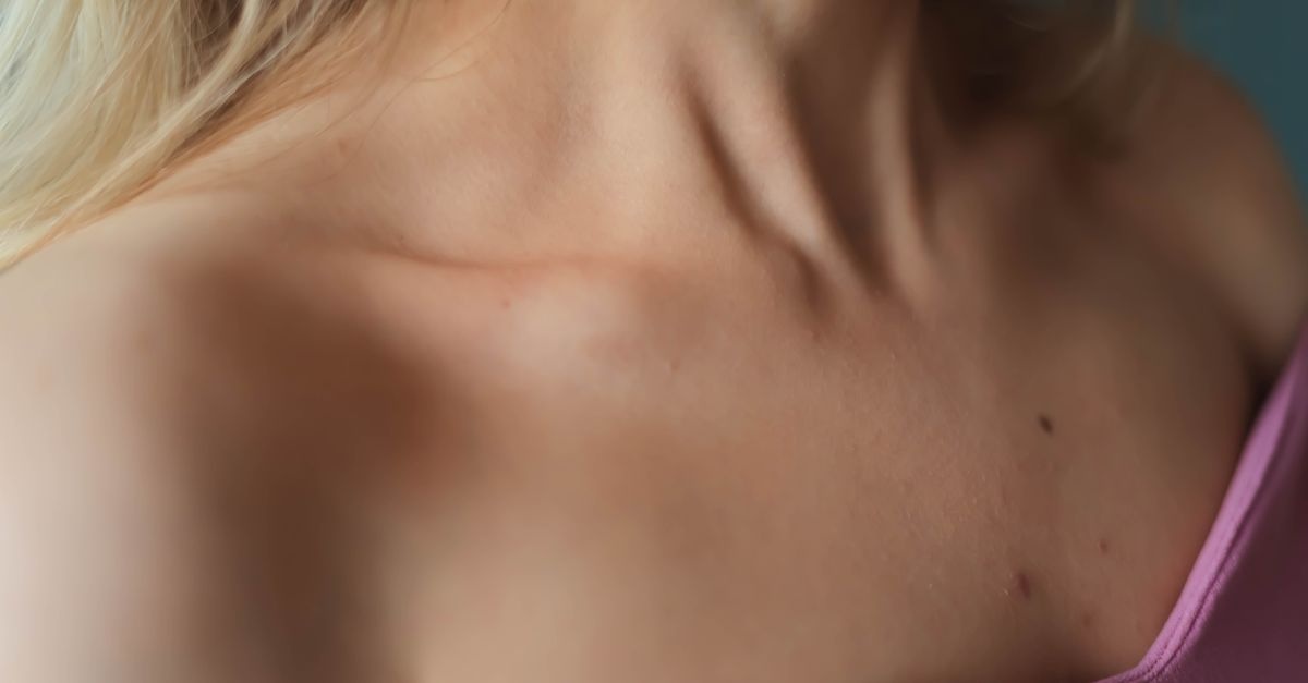 Cera naczynkowa pod kontrolą: kojąca pielęgnacja i codzienne nawyki, które działają
